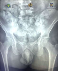 1741335850241 20432 s4